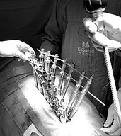 Cirugía de escoliosis, neurocirujano de columna